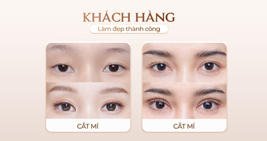 Viện thẩm mỹ Quốc Tế Adela 24 Bà triệu