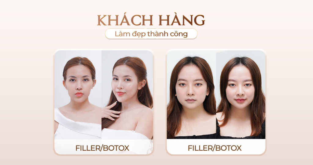 Viện thẩm mỹ Quốc Tế Adela 24 Bà triệu