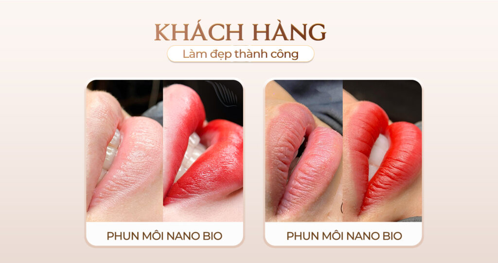 Viện thẩm mỹ Quốc Tế Adela 24 Bà triệu