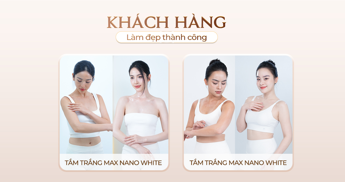 Nâng mũi giúp cải thiện khuôn mặt