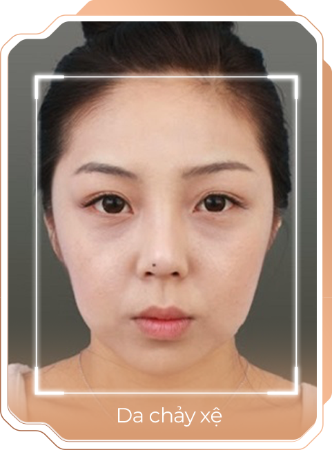 Viện thẩm mỹ Quốc Tế Adela 24 Bà triệu