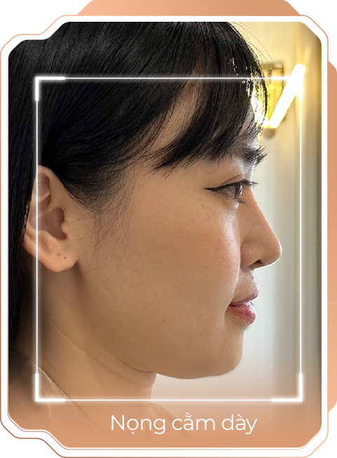 Viện thẩm mỹ Quốc Tế Adela 24 Bà triệu