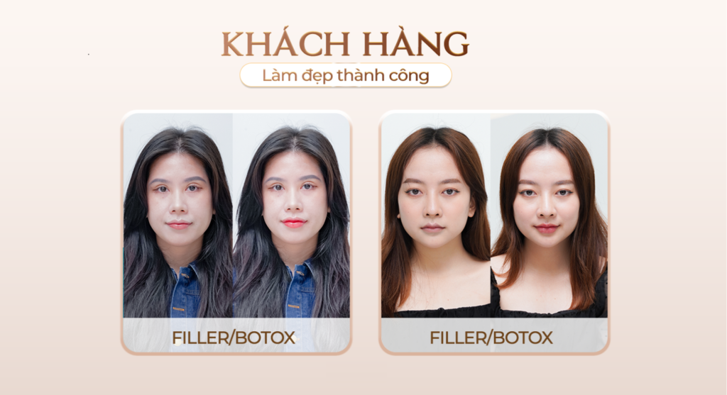 Viện thẩm mỹ Quốc Tế Adela 24 Bà triệu