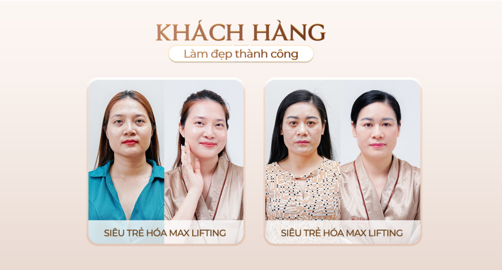 Viện thẩm mỹ Quốc Tế Adela 24 Bà triệu