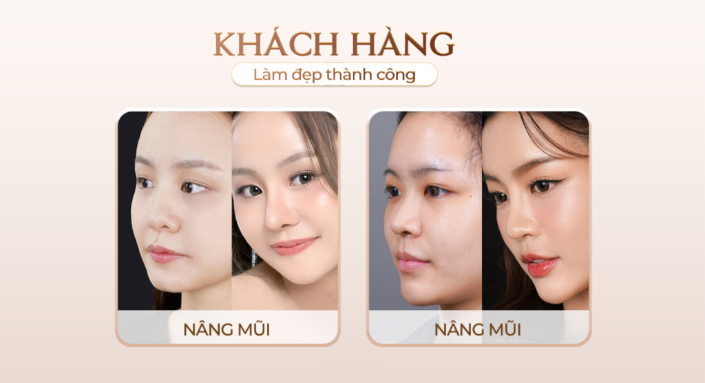 Viện thẩm mỹ Quốc Tế Adela 24 Bà triệu