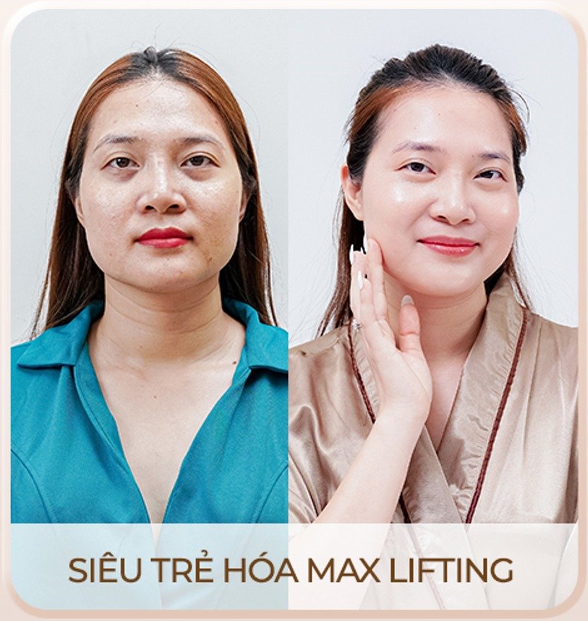 Viện thẩm mỹ Quốc Tế Adela 24 Bà triệu