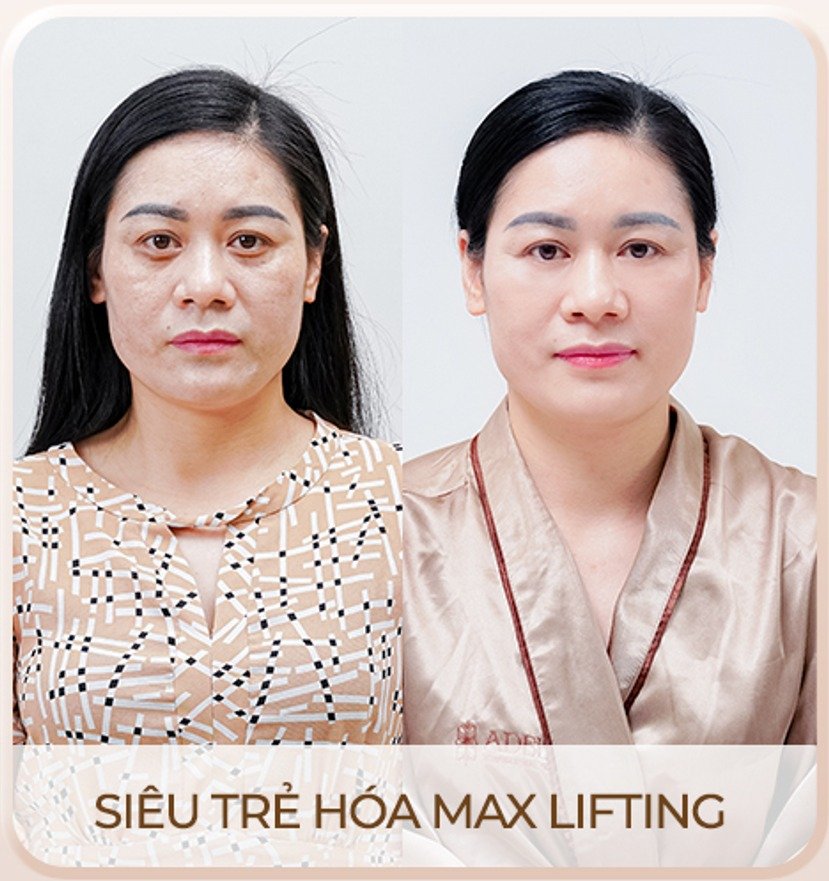 Viện thẩm mỹ Quốc Tế Adela 24 Bà triệu