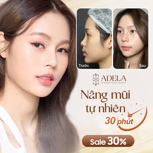 Viện thẩm mỹ Quốc Tế Adela 24 Bà triệu