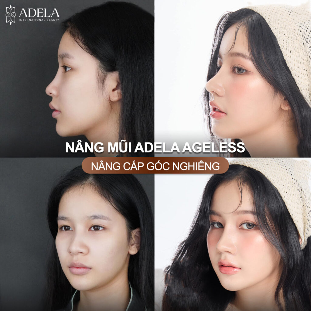 Viện thẩm mỹ Quốc Tế Adela 24 Bà triệu