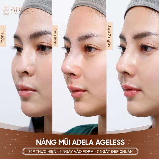 Viện thẩm mỹ Quốc Tế Adela 24 Bà triệu