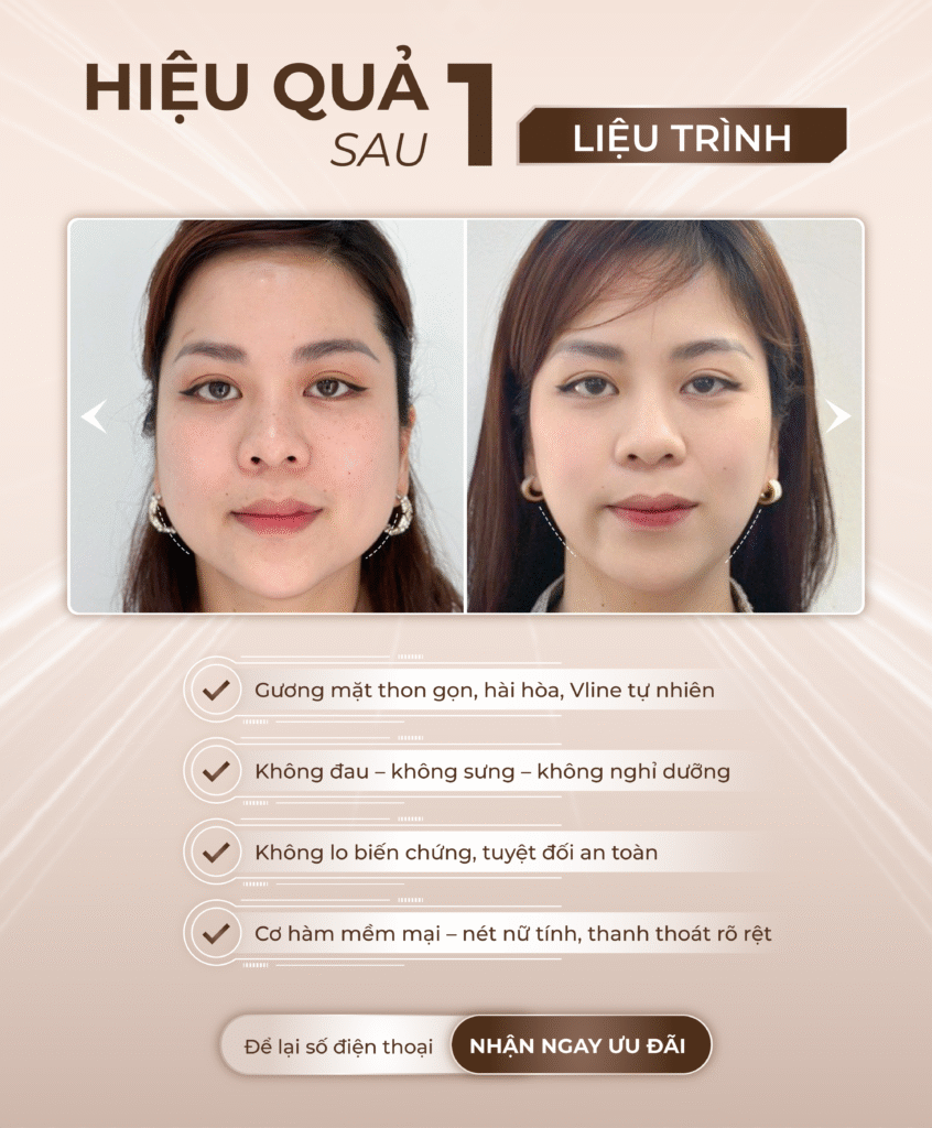 Viện thẩm mỹ Quốc Tế Adela 24 Bà triệu