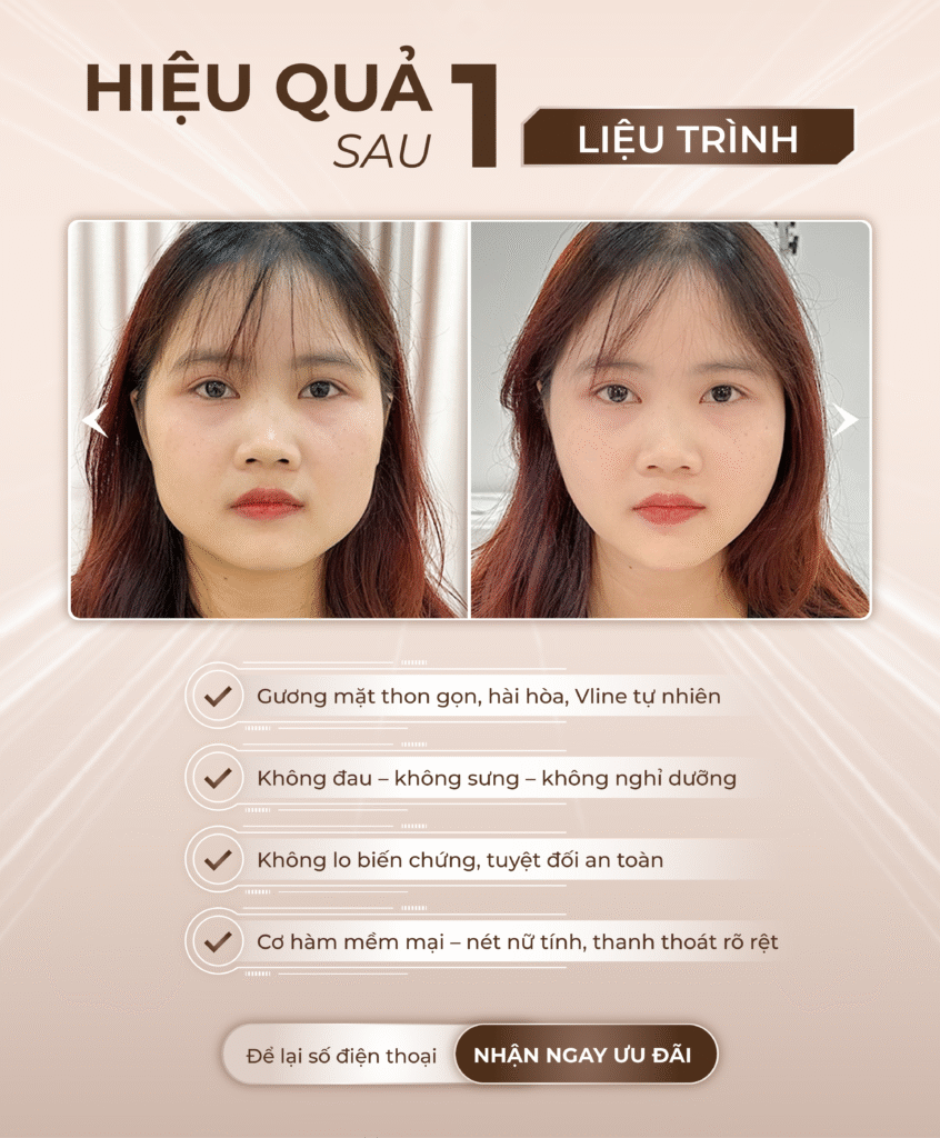 Viện thẩm mỹ Quốc Tế Adela 24 Bà triệu