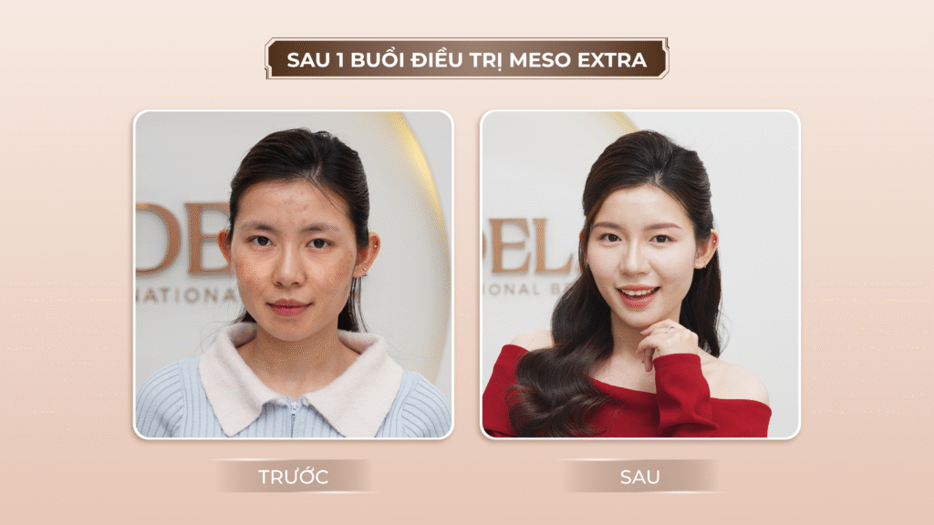 Viện thẩm mỹ Quốc Tế Adela 24 Bà triệu