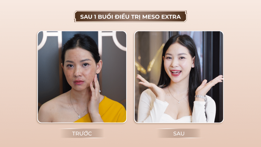 Viện thẩm mỹ Quốc Tế Adela 24 Bà triệu