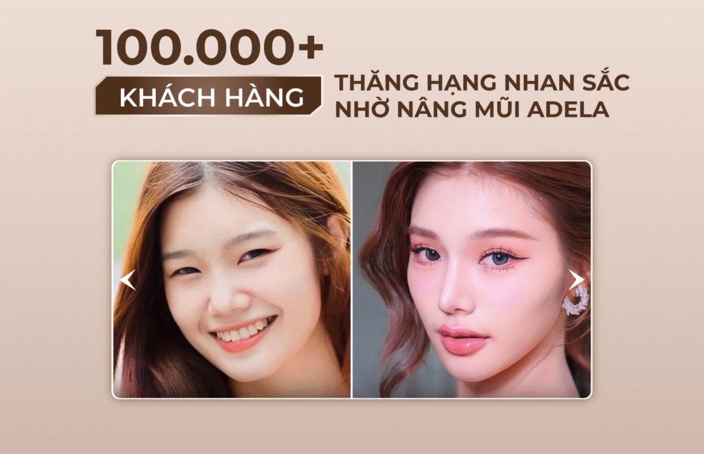 Viện thẩm mỹ Quốc Tế Adela 24 Bà triệu