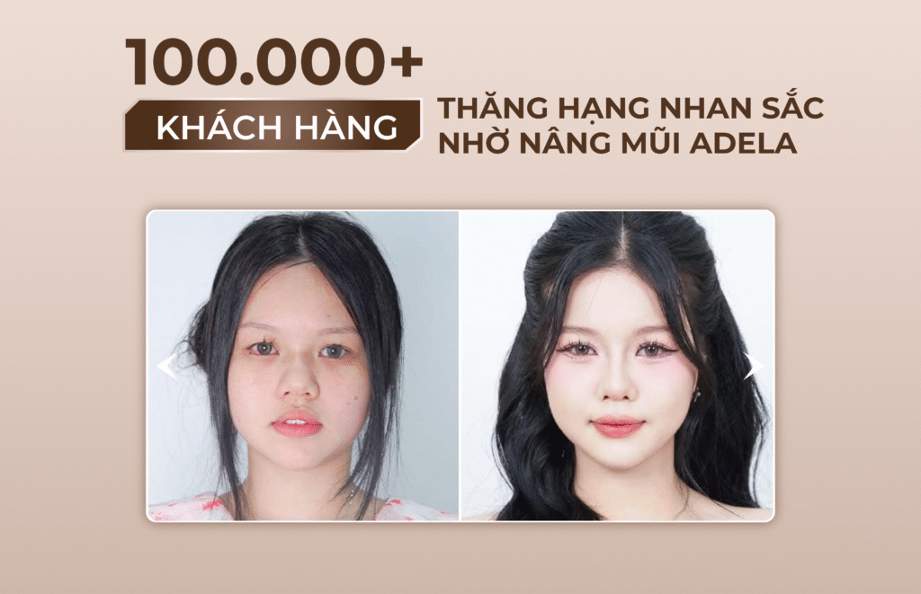 Viện thẩm mỹ Quốc Tế Adela 24 Bà triệu