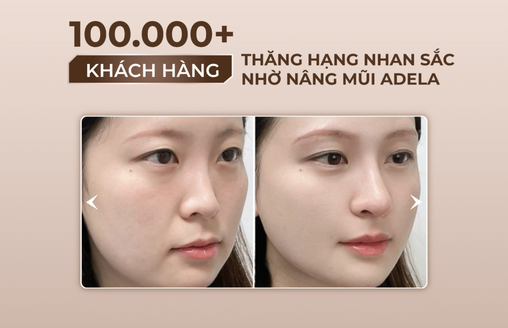 Viện thẩm mỹ Quốc Tế Adela 24 Bà triệu