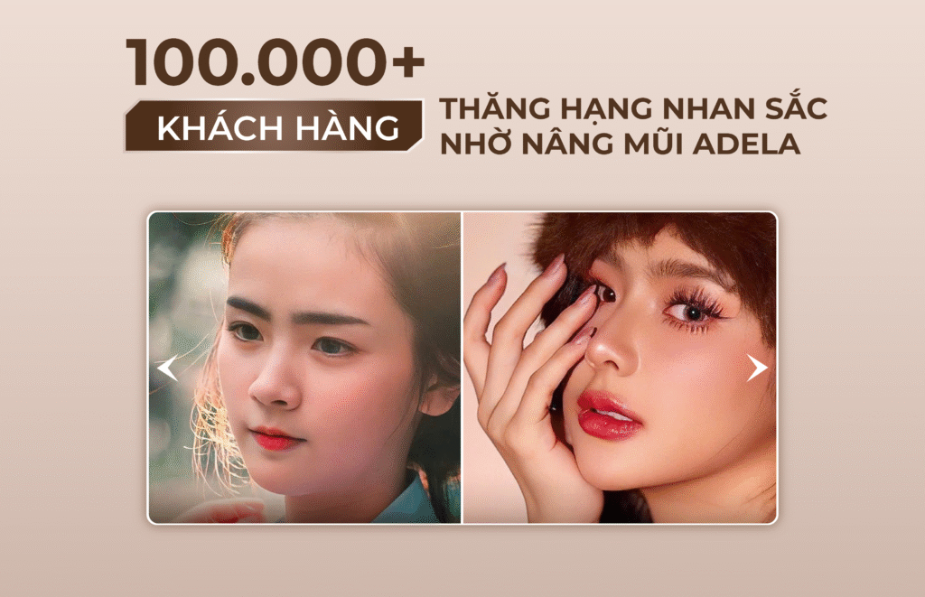 Viện thẩm mỹ Quốc Tế Adela 24 Bà triệu