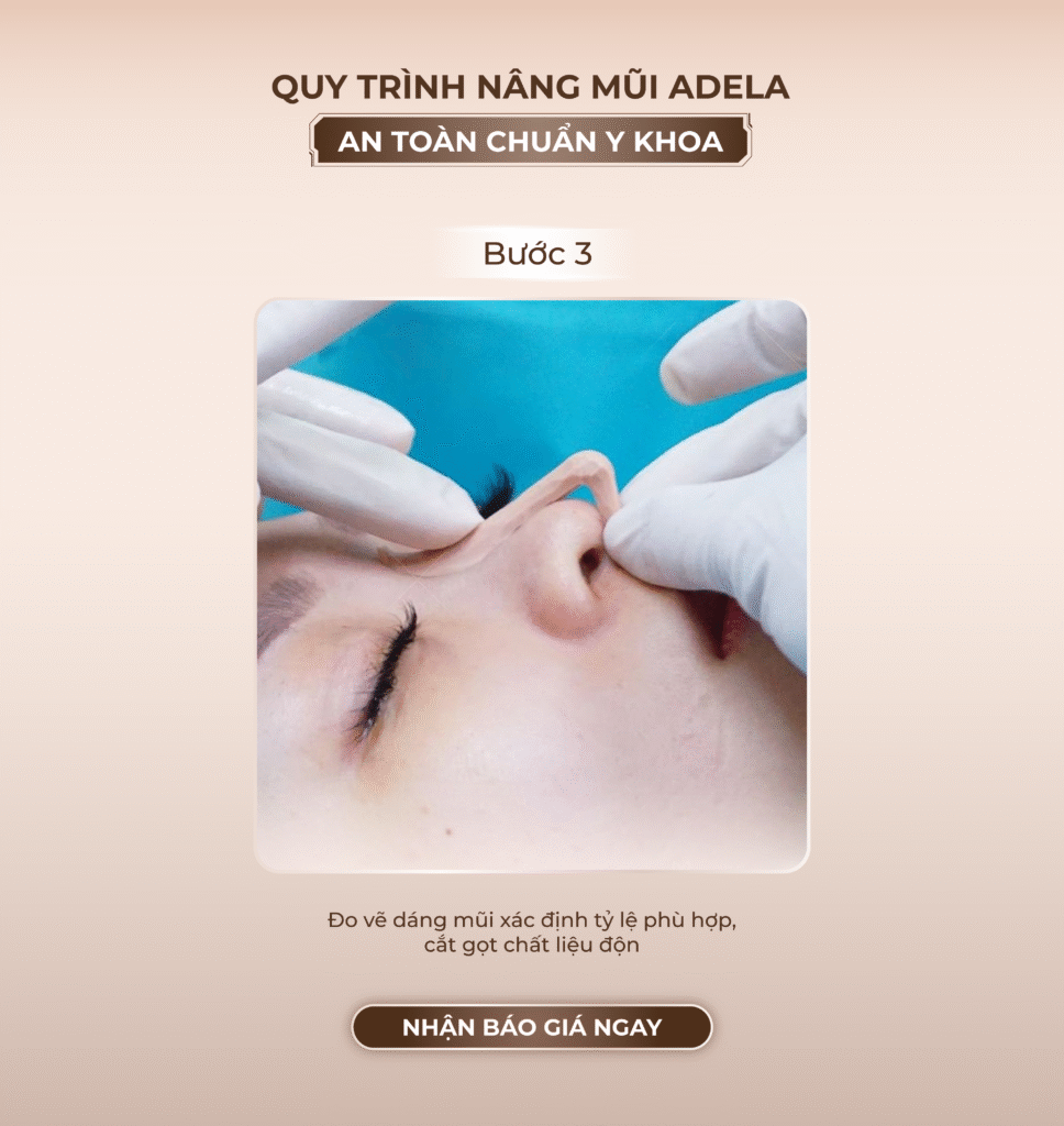 Viện thẩm mỹ Quốc Tế Adela 24 Bà triệu