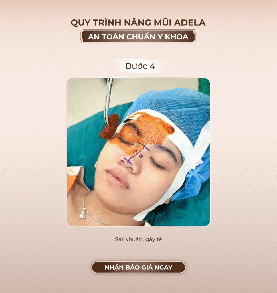 Viện thẩm mỹ Quốc Tế Adela 24 Bà triệu