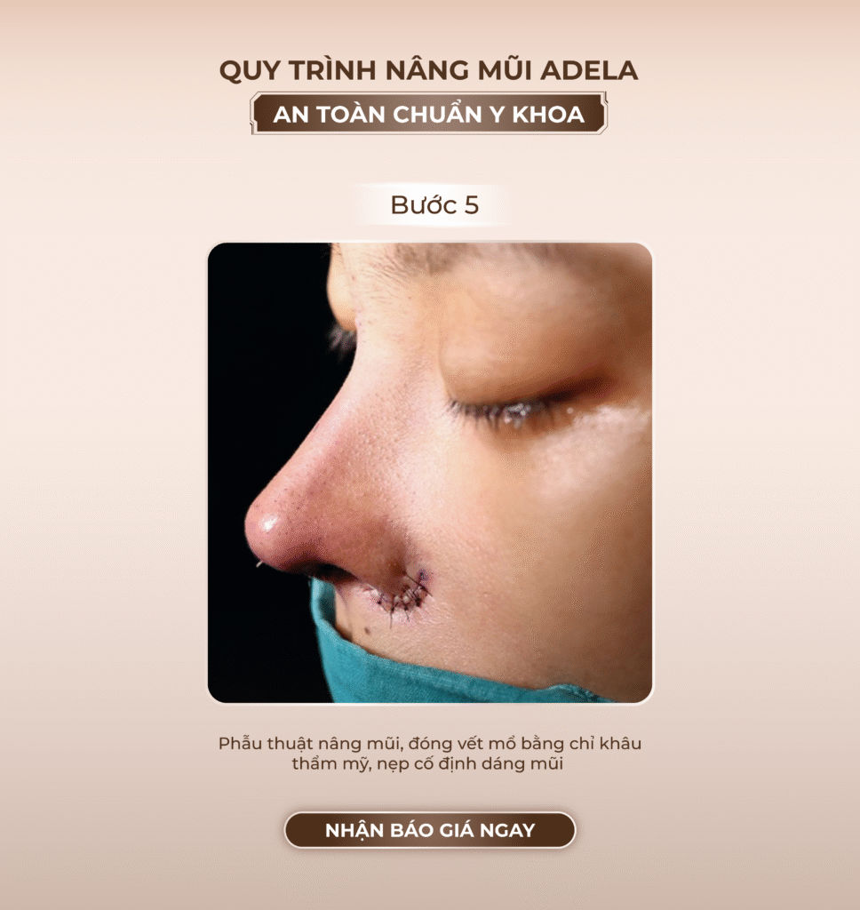 Viện thẩm mỹ Quốc Tế Adela 24 Bà triệu
