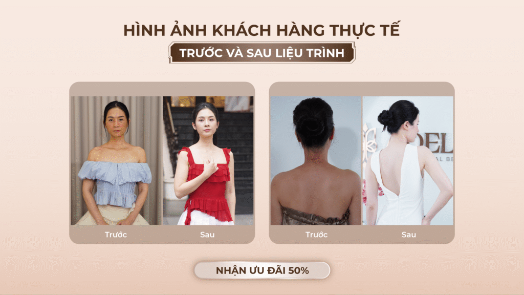 Viện thẩm mỹ Quốc Tế Adela 24 Bà triệu