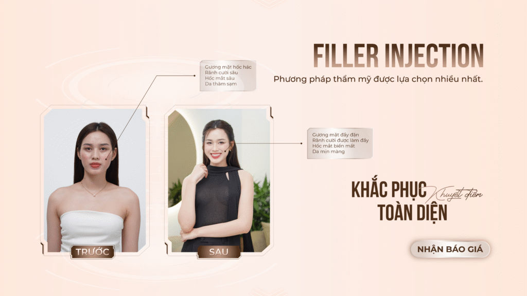 Viện thẩm mỹ Quốc Tế Adela 24 Bà triệu