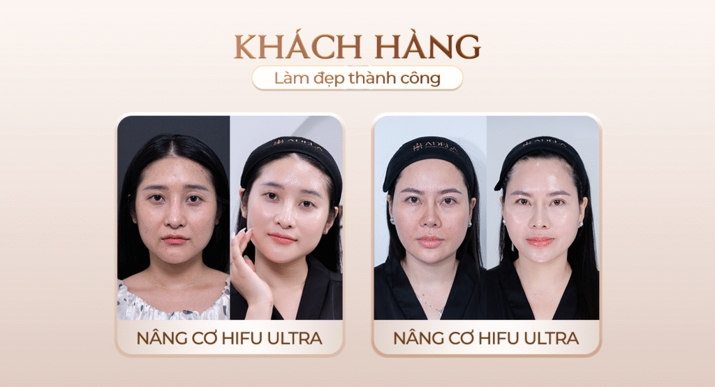 Viện thẩm mỹ Quốc Tế Adela 24 Bà triệu